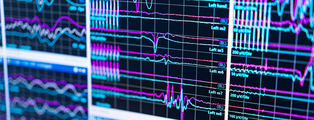 Image of brain waves on a computer screen
